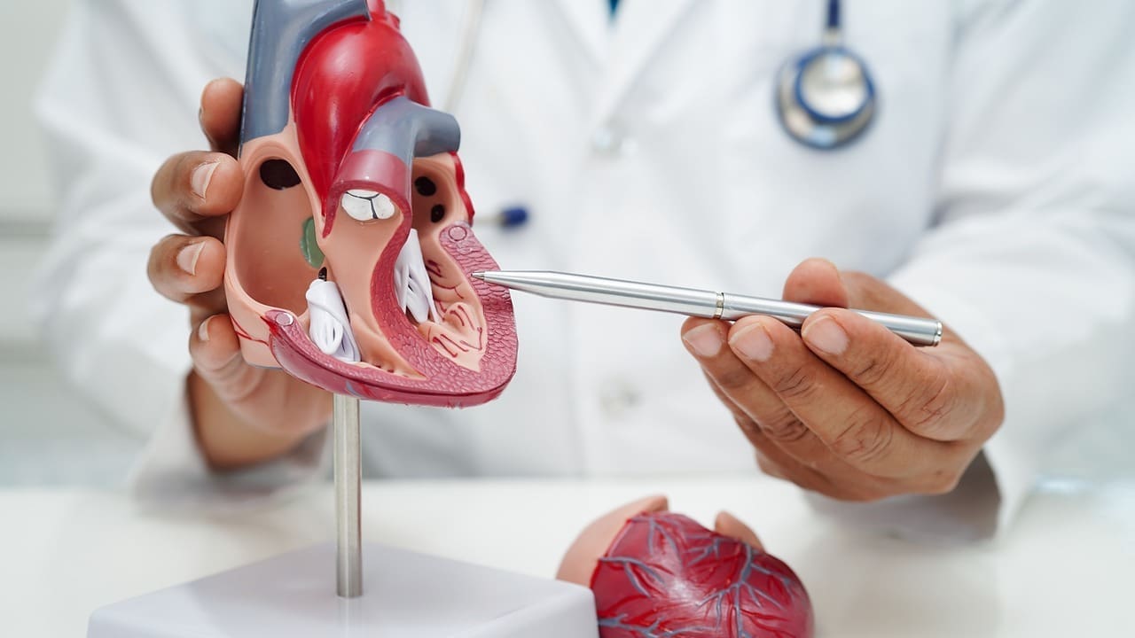 ectasia of the ascending aorta LIV Hospital