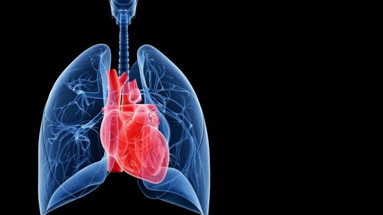 What Is Ectasia of the Thoracic Aorta and How Is It Diagnosed?