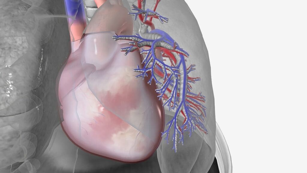 thoracic aortic aneurysm