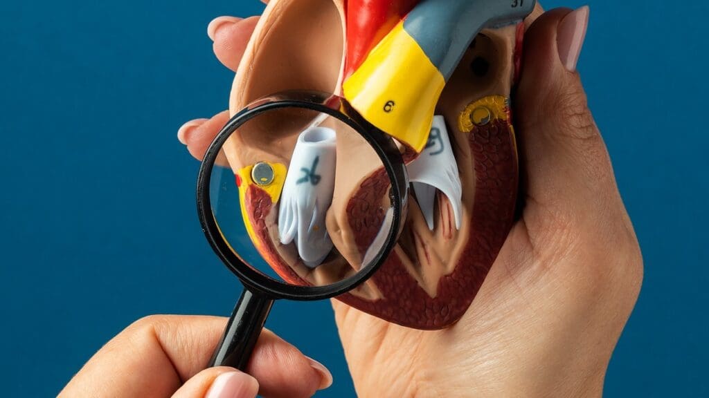 prosthetic heart valve endocarditis prosthetic heart valve endocarditis