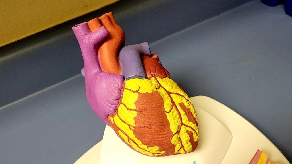 heart murmur classification