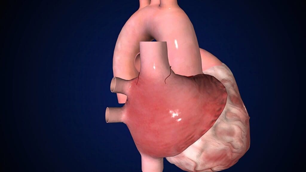 aortic valve anatomy