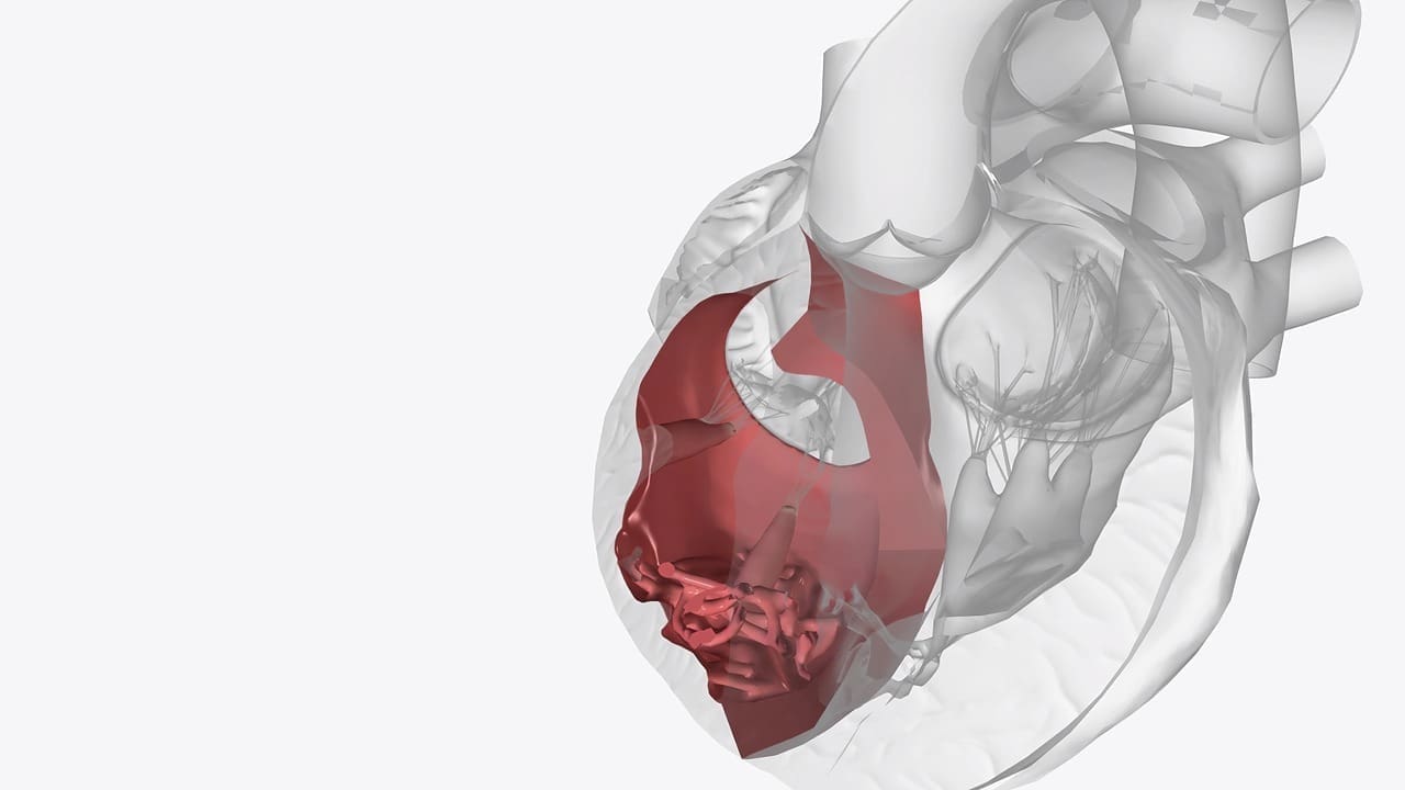 calcification of heart valves LIV Hospital