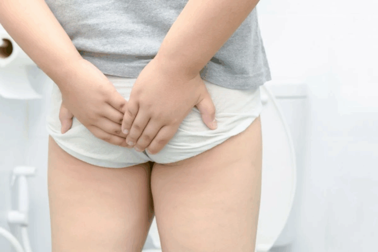 Anal Fistula Treatment: 7 Key Facts