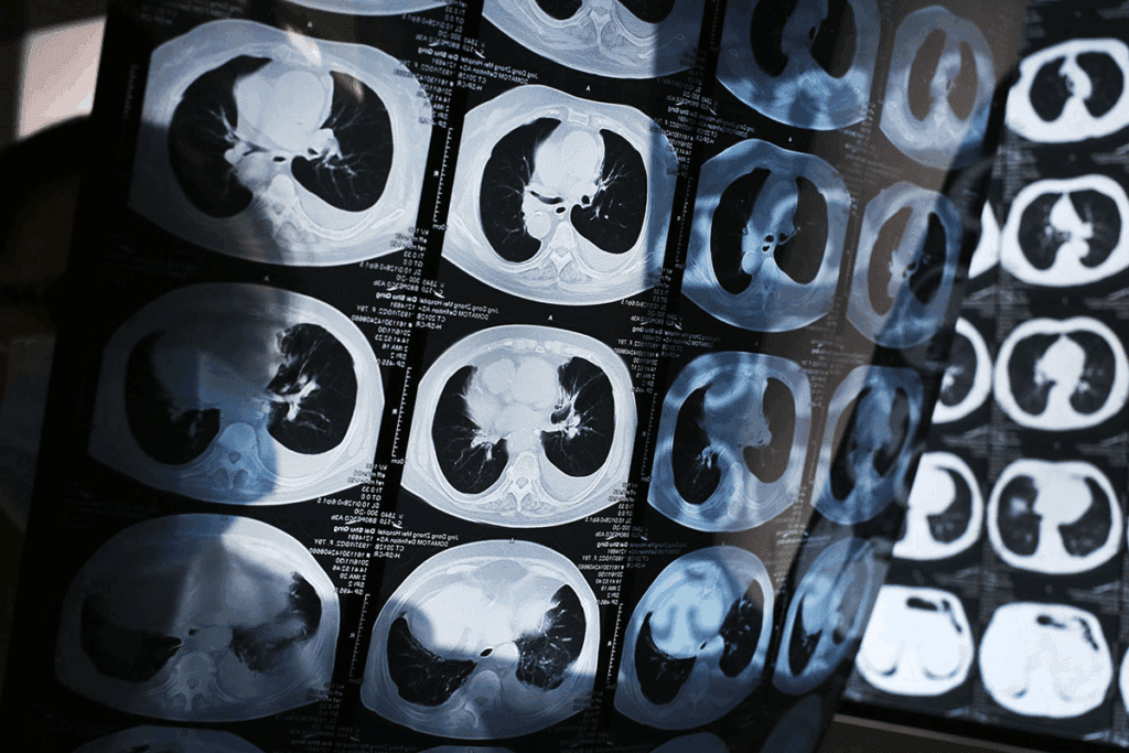 How to Prepare for a Best CT Biopsy Guide