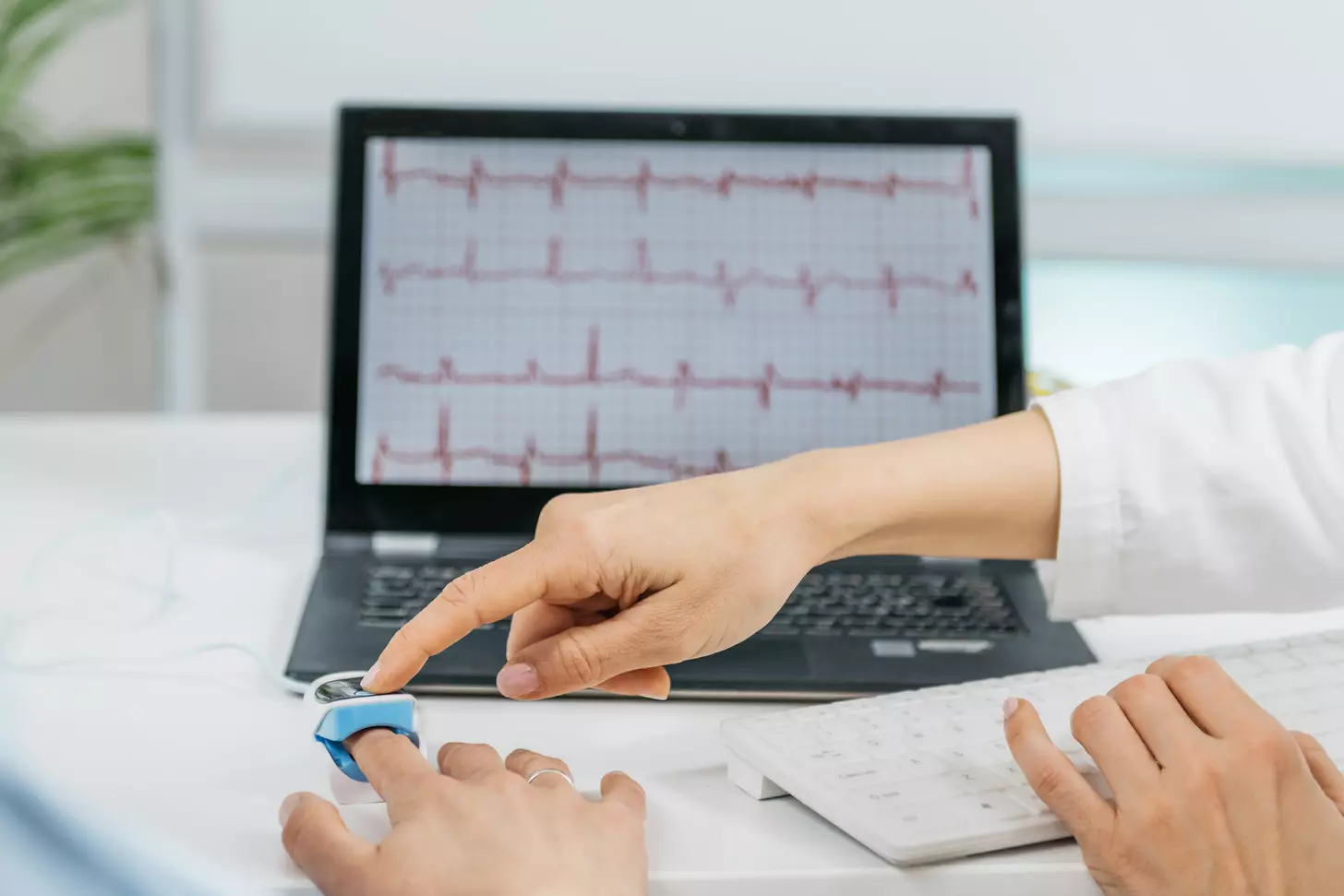 What Is Paroxysmal Atrial Fibrillation and How Does It Affect the Heart?