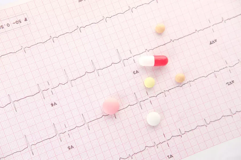 What Is Atrial Fibrillation Flutter