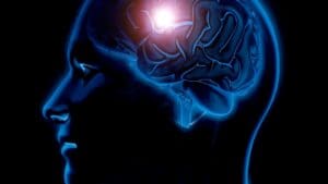 7 Key Signs of Swollen Brain and Practical Ways to Reduce Brain Edema