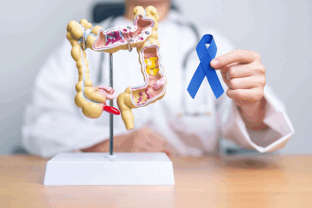 Colorectal Cancer Specialists: How They Treat