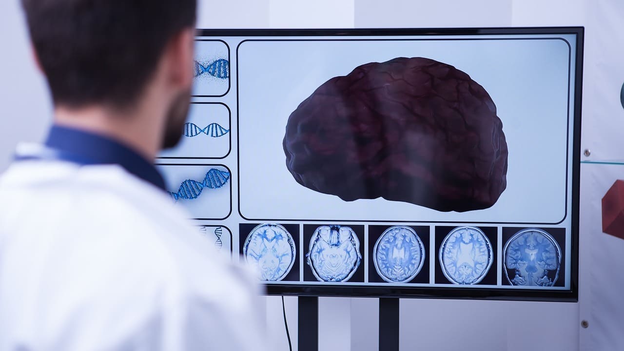 Pontine Tumors in Adults: 7 Key Facts on Symptoms, Diagnosis, and Treatment