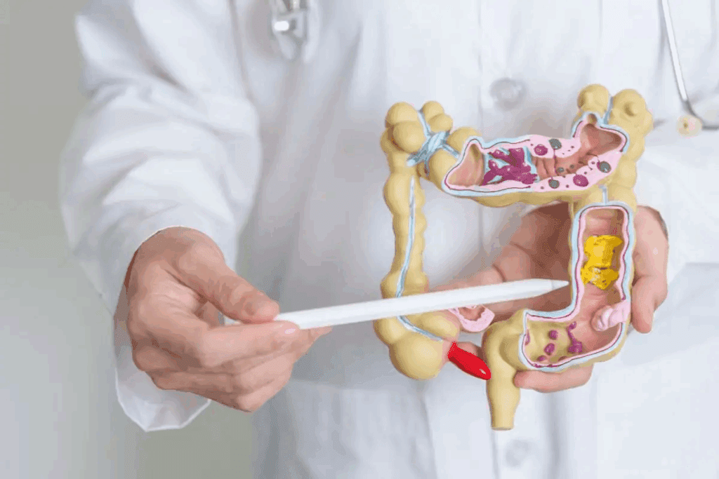Small Bowel Obstruction: 7 Critical Causes & Dangers 2 Small Bowel Obstruction: 7 Critical Causes & Dangers