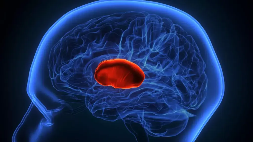 A detailed 3D anatomical cross-section of the human brain, with a highlighted region indicating early signs of cancerous growth. The image should be rendered in a scientific, clinical style, with muted tones and a focus on accuracy and detail. The lighting should be soft and directional, casting subtle shadows to emphasize the 3D structure. The camera angle should be slightly elevated, providing a clear view of the affected area. The overall atmosphere should convey a sense of concern and the importance of early detection, without being overly dramatic or alarmist.