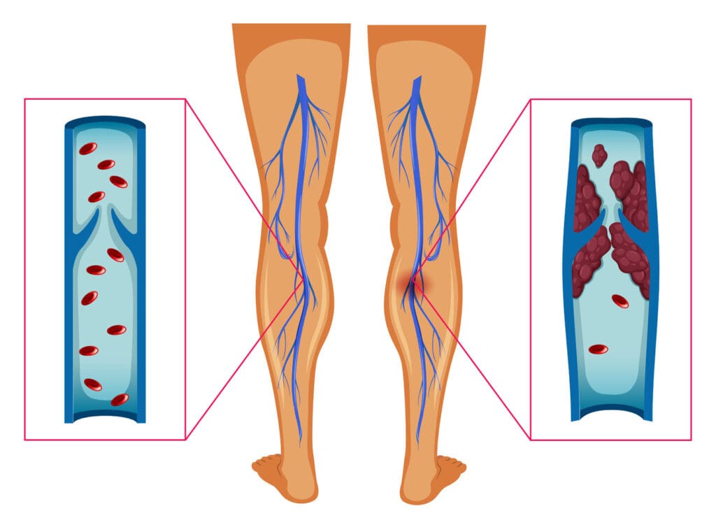 arteries behind the knee