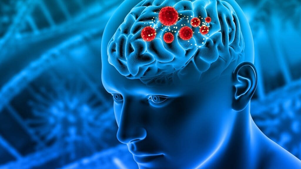 brain tumor surgery complexity