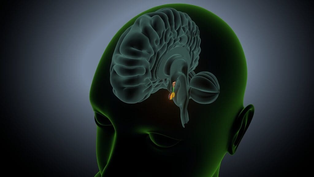 What Are Brain Stem Tumors What Are Brain Stem Tumors