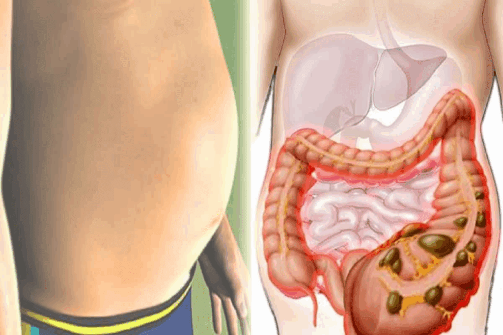 Bile Leak Symptoms: 10 Alarming Warning Signs