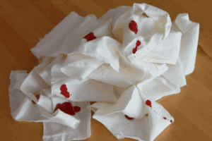 Bloody Stool After Surgery: 7 Common, Alarming Causes