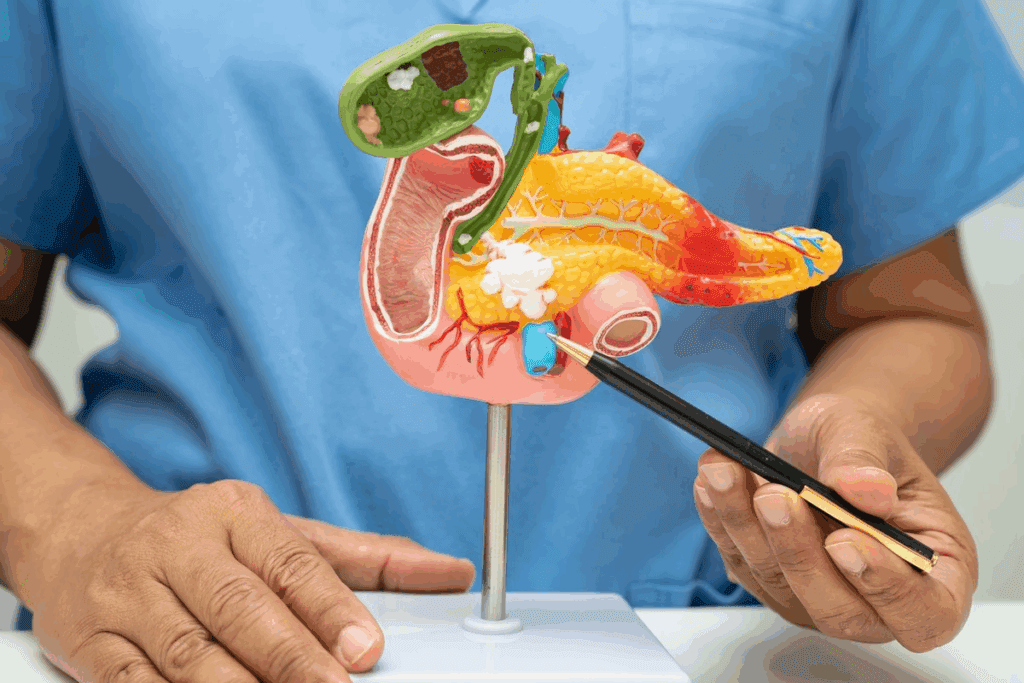 Cholangiocarcinoma Surgery: 7 Vital Facts 2 Cholangiocarcinoma Surgery: 7 Vital Facts