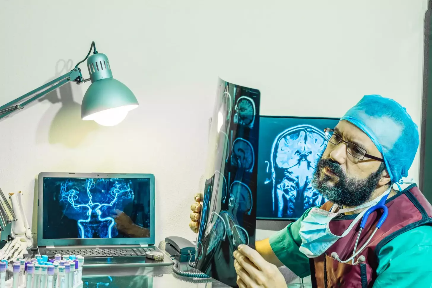 Bulging Eye Brain Tumor: 7 Key Facts About Meningiomas You Should Know