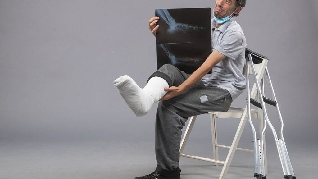 Incomplete Paraplegia