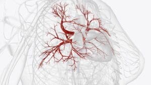 Angiogram Definition: Meaning, Medical Terminology, and How It Works