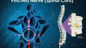 What Does a Bump on the Backbone Mean? Causes, Symptoms, and When to Worry