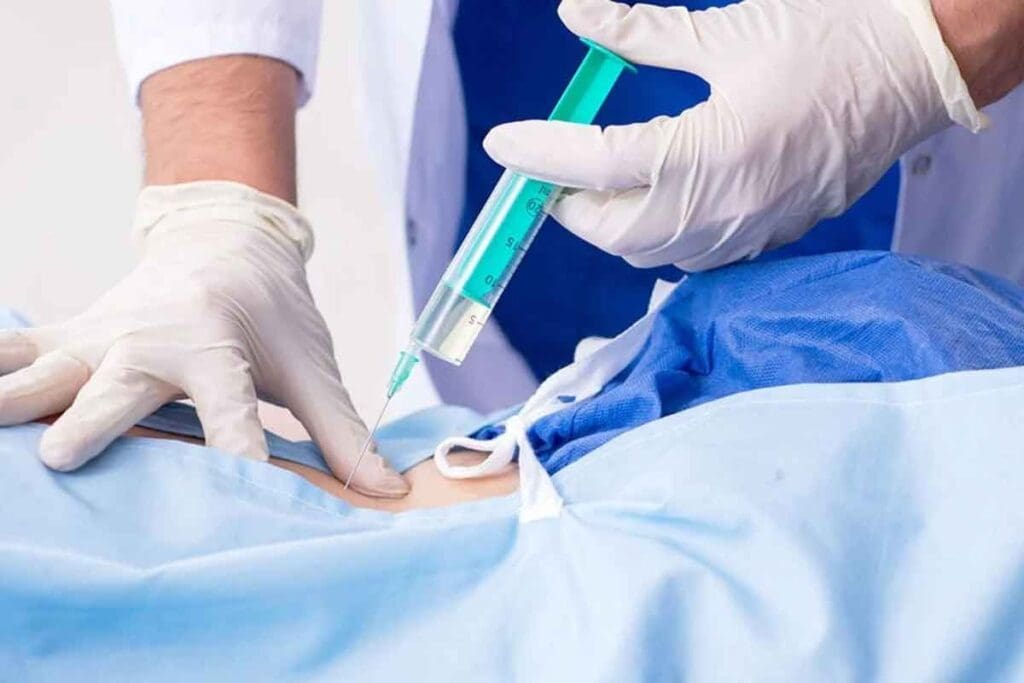 Back Pain After Epidural Steroid Injection Explained 3 Back Pain After Epidural Steroid Injection Explained