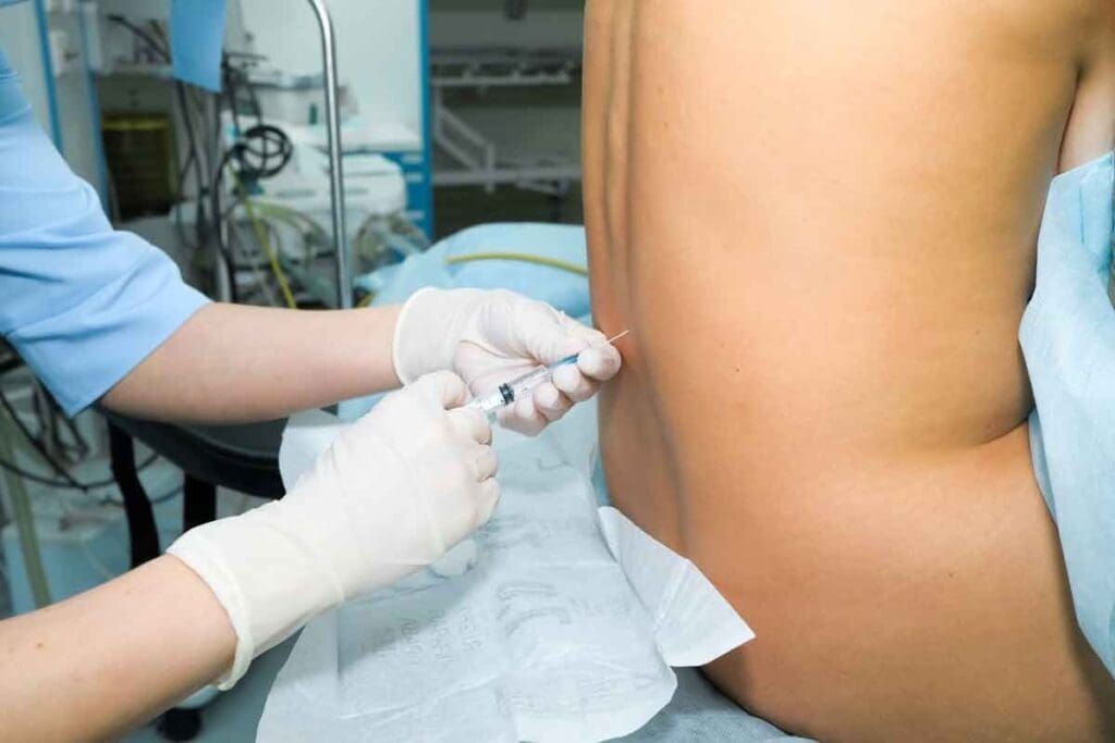 How Long Do Epidural Steroid Injection Side Effects Last