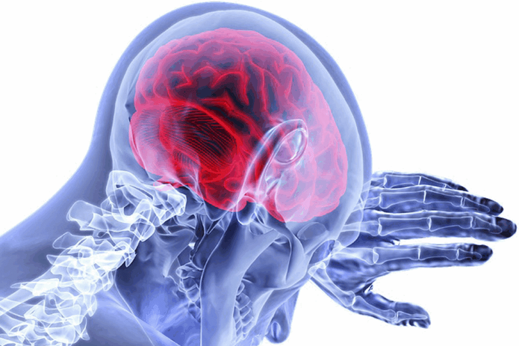 How to coil embolization aneurysm: Step-by-Step Procedure 1 How to coil embolization aneurysm: Step-by-Step Procedure