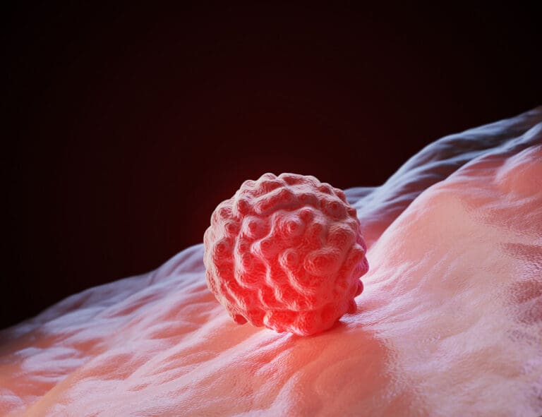 How Fast Do Benign Tumors Grow Compared to Malignant Tumors, and Can They Become Cancerous?
