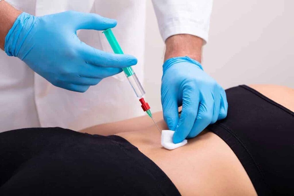 Next Step After Epidural Steroid Injection Explained