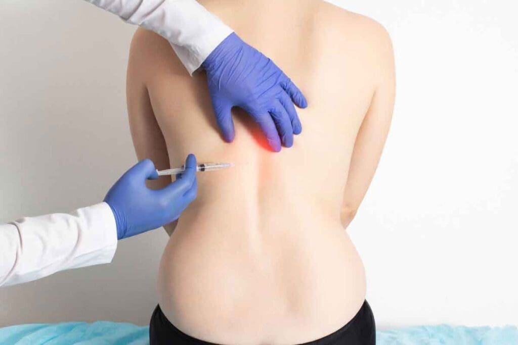 Next Step After Epidural Steroid Injection Explained