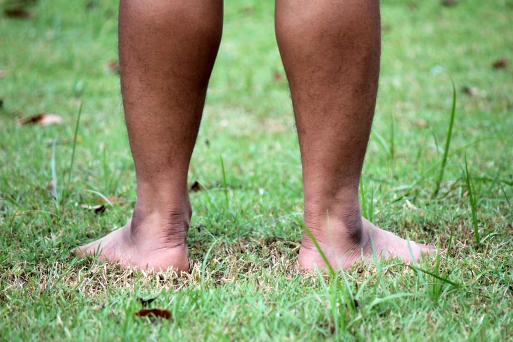 15 Types of Non Cancerous Tumors That Can Appear as Blue Lumps or Leg Masses