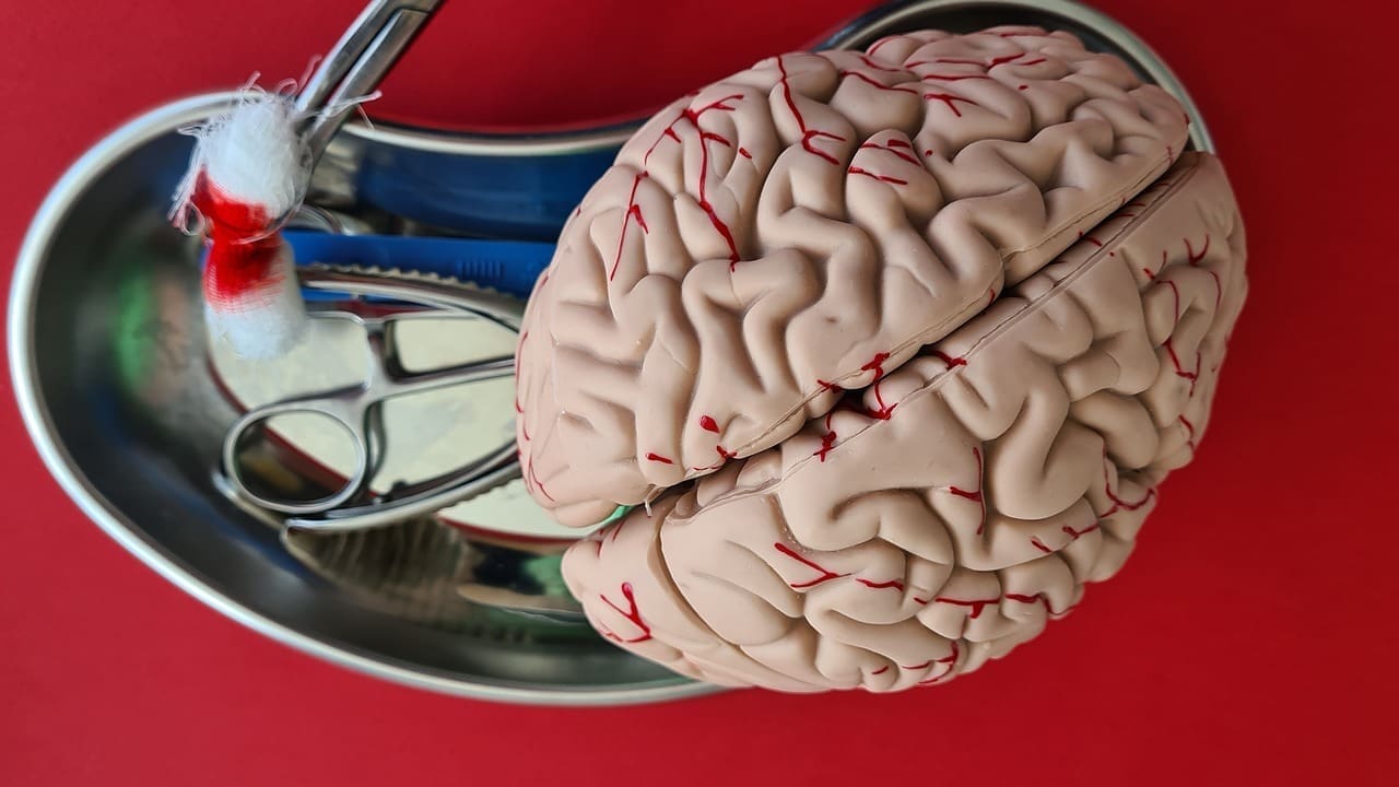 What Do Lesions on the Brain Indicate? Causes, Symptoms, and Key Diseases Explained 1 What Do Lesions on the Brain Indicate? Causes, Symptoms, and Key Diseases Explained