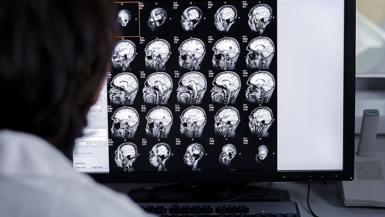 How to Read Abnormal MRI Brain Reports: Step-by-Step Interpretation Guide 1 How to Read Abnormal MRI Brain Reports: Step-by-Step Interpretation Guide