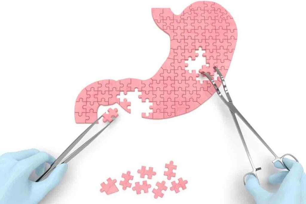 After Stomach Surgery Exercises: 10 Essential Safe Moves 1 After Stomach Surgery Exercises: 10 Essential Safe Moves