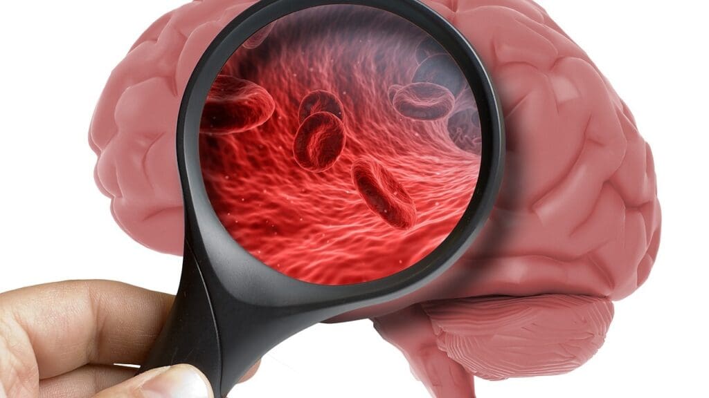 traumatic brain injury