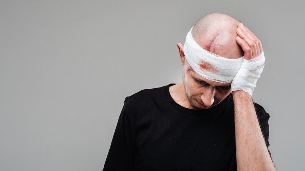 traumatic brain injury