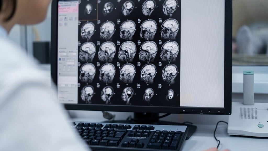 CT scan of the brain