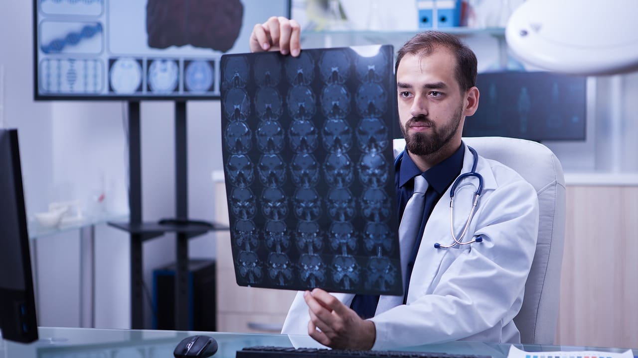 What Can a CT Scan of the Brain Show About Brain Damage?