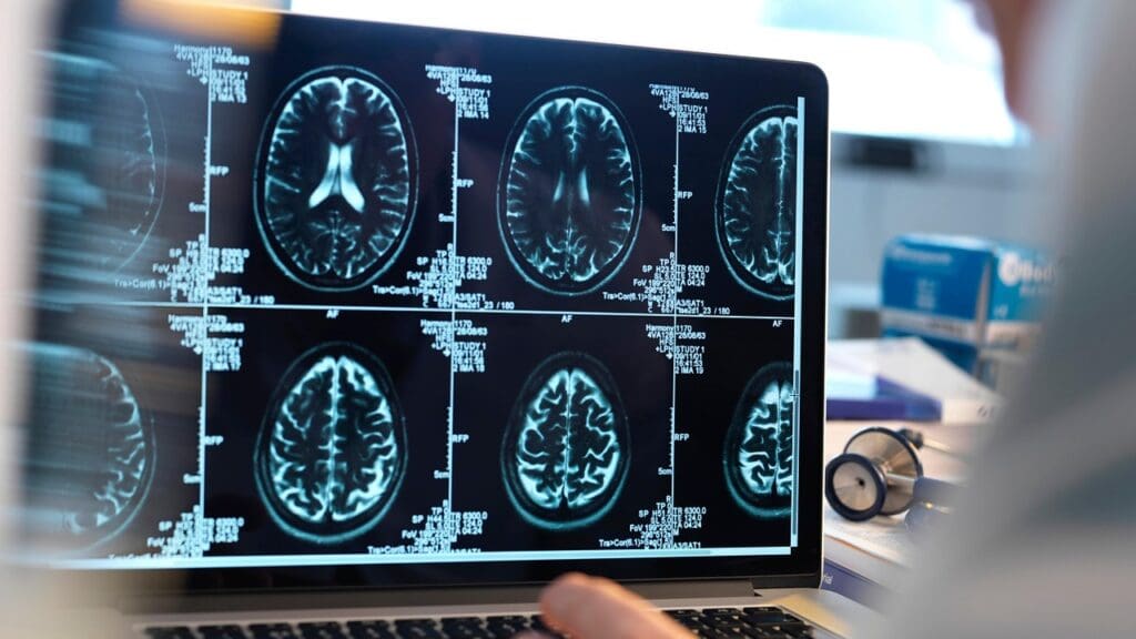 MRI brain imaging technology MRI brain imaging technology