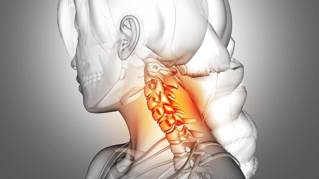 How to Undergo ACDF C Spine Surgery: Step-by-Step Process & Tips