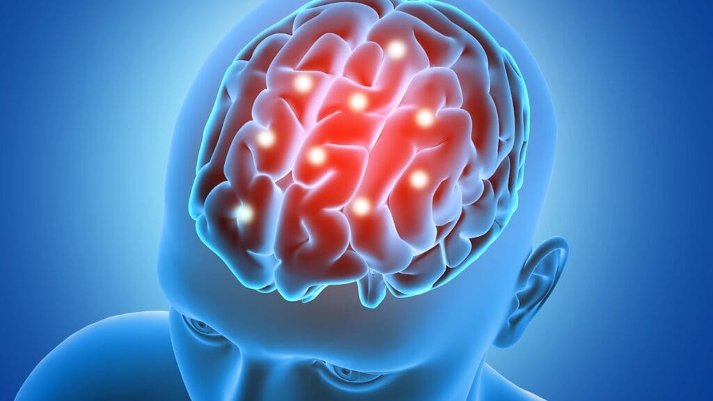 What Are the Symptoms and Treatment Options for a Frontal Lobe Brain Cyst? 1 What Are the Symptoms and Treatment Options for a Frontal Lobe Brain Cyst?