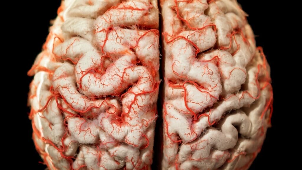 What is a Cerebellar Cyst and How is it Treated?