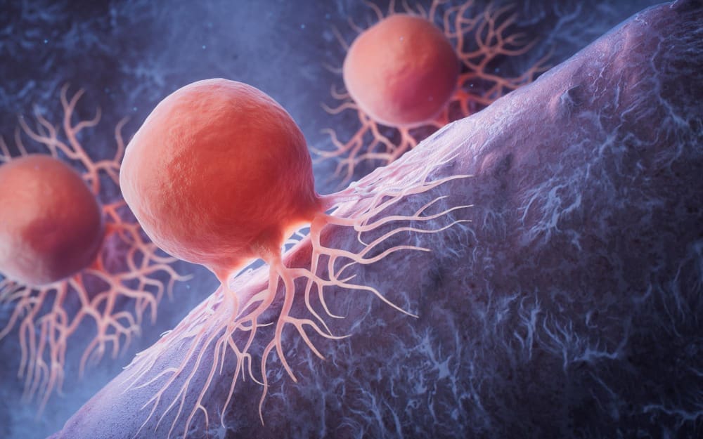 How Do Non Malignant Tumors Grow and What Makes a Tumor Malignant?