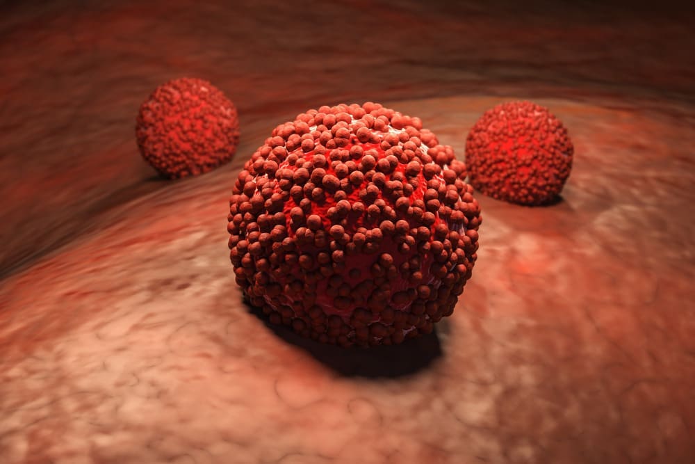 What Is a Tumor Made Of and How Are Benign Tumors Different?