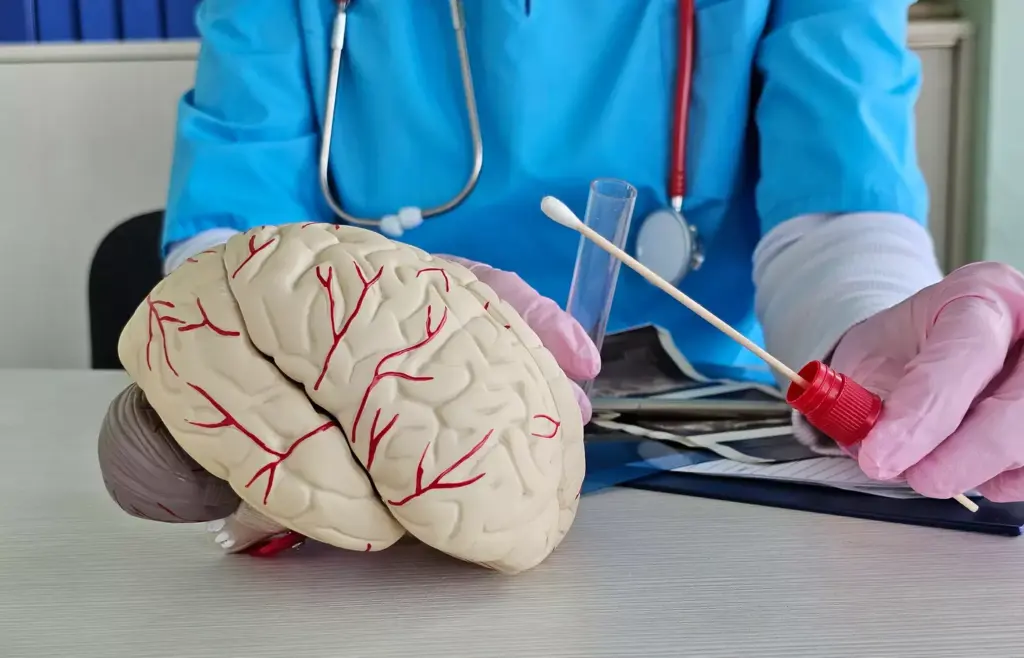 What Is a Cerebral Arteriovenous Malformation?