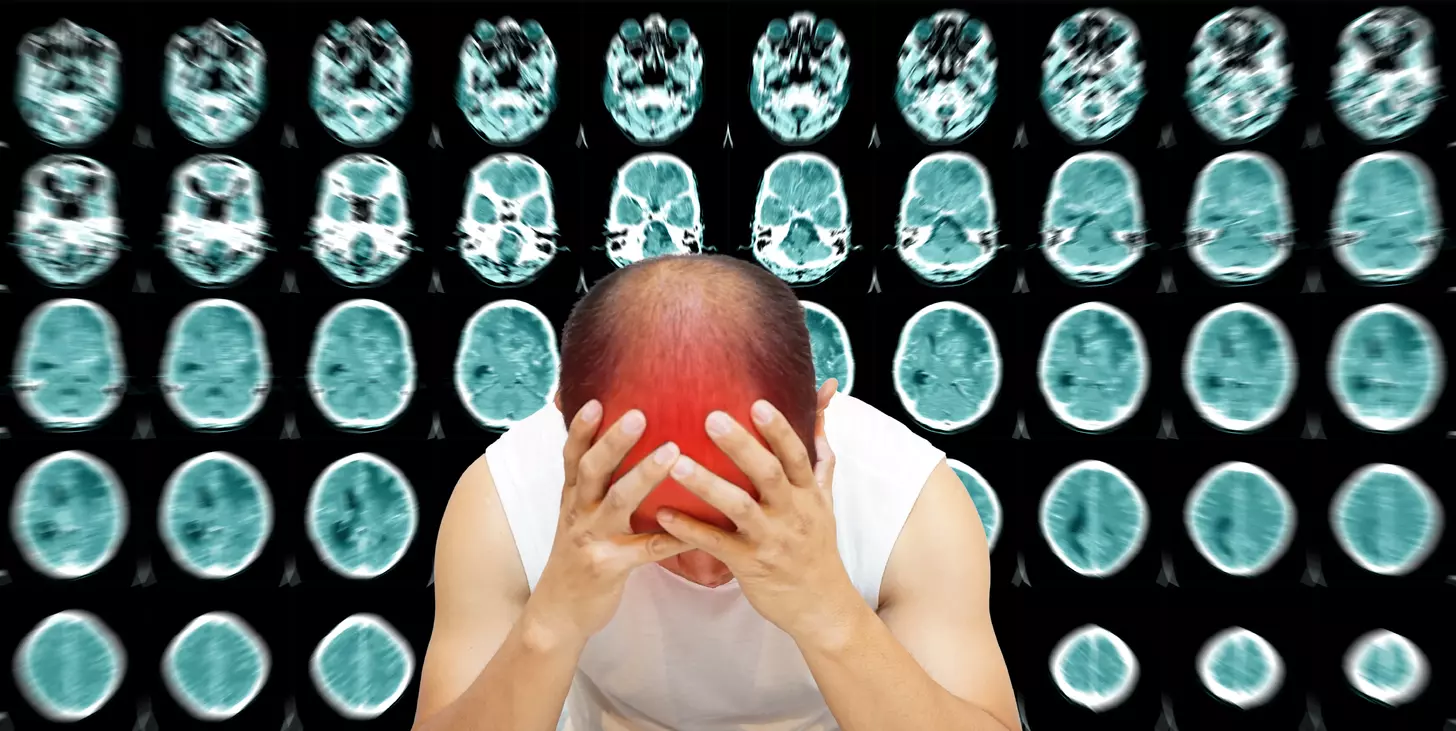 10 Key Autoimmune Encephalomyelitis Symptoms and What Triggers Brain Autoimmunity