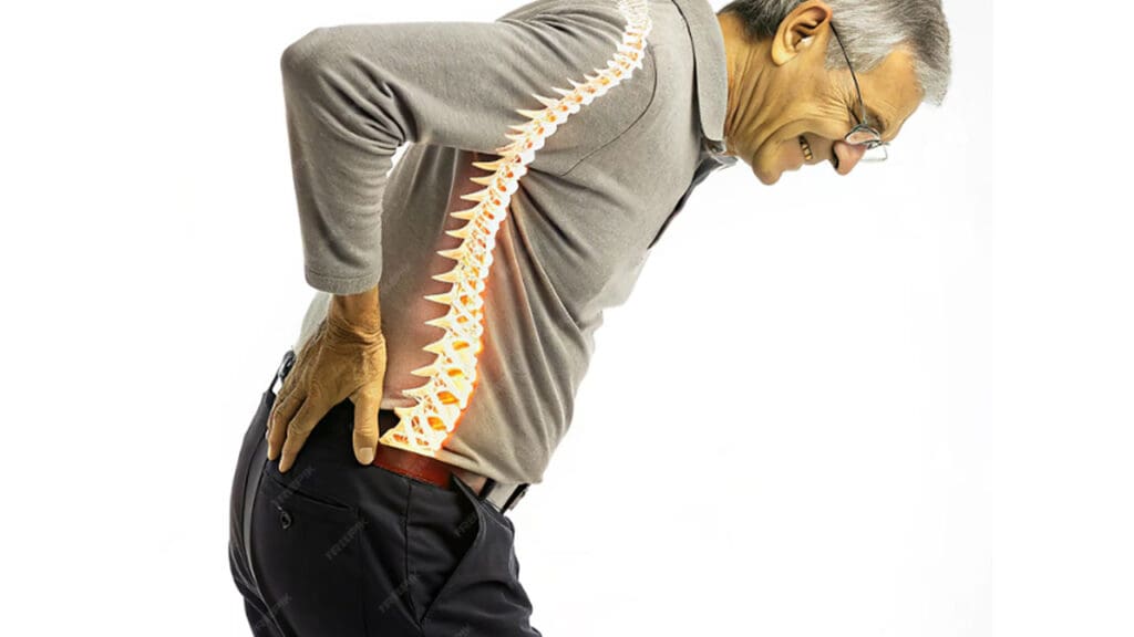 bulging vs slipped disc