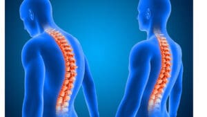 What Is the Difference Between a Bulging Disc and a Slipped or Herniated Disc?